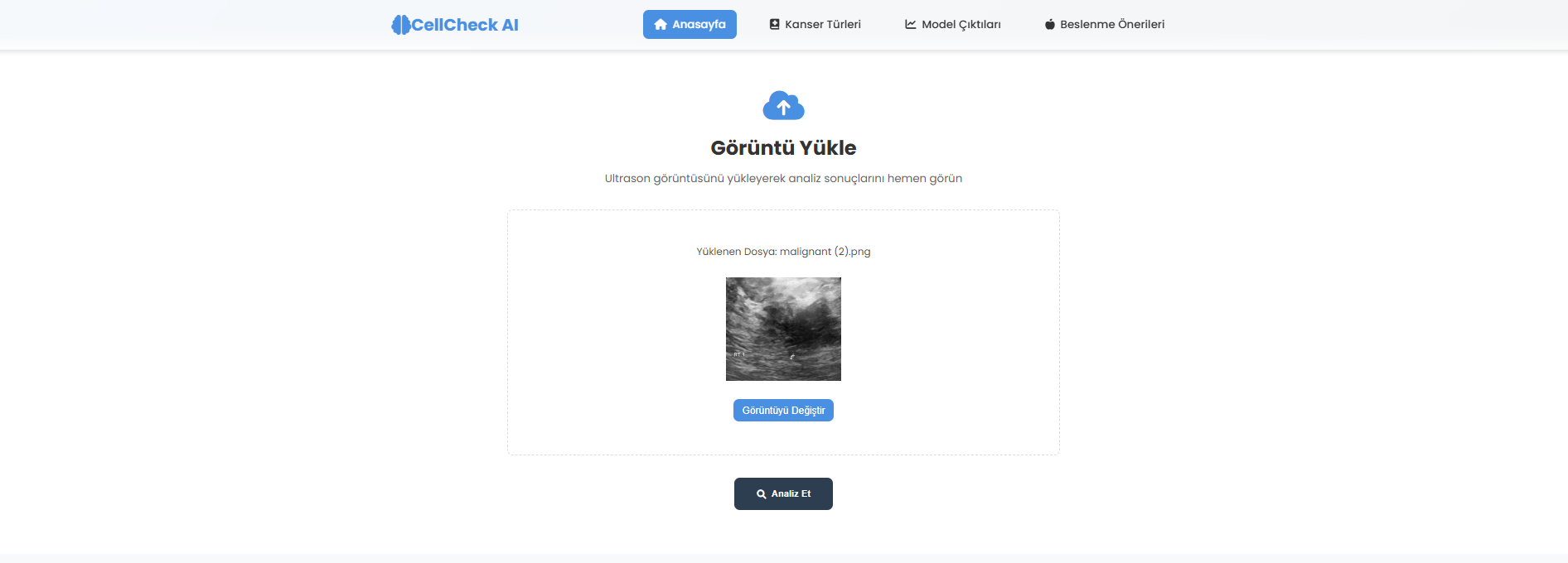 Mamografi Yükleme Modülü